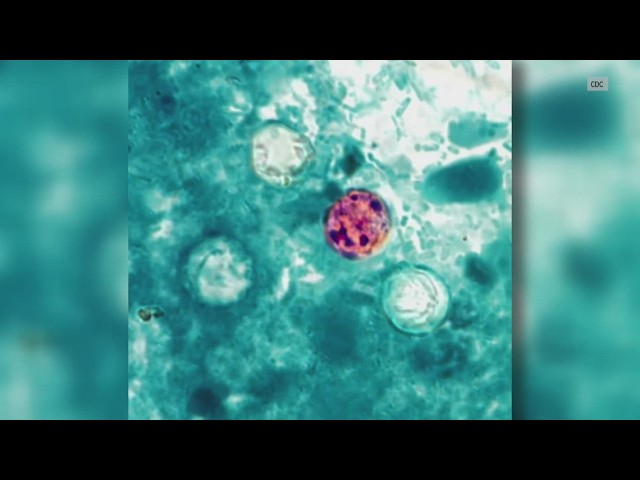 What Californians need to know about Cyclospora right now