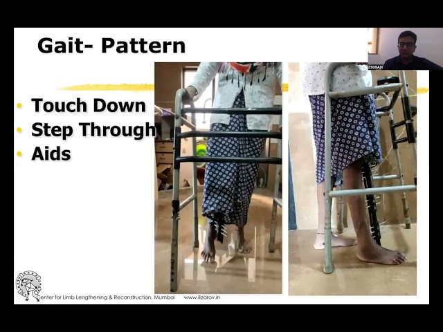 Post Op care  - Dr Ajit Chalak