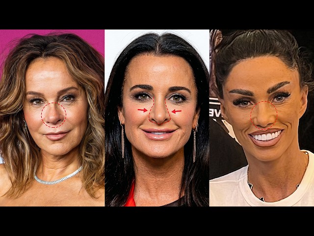 these celebrity nose jobs went too far