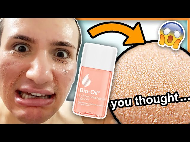 I tried BIO OIL on my face for ONE WEEK!! (my mom really thought this was a miracle oil... lol)