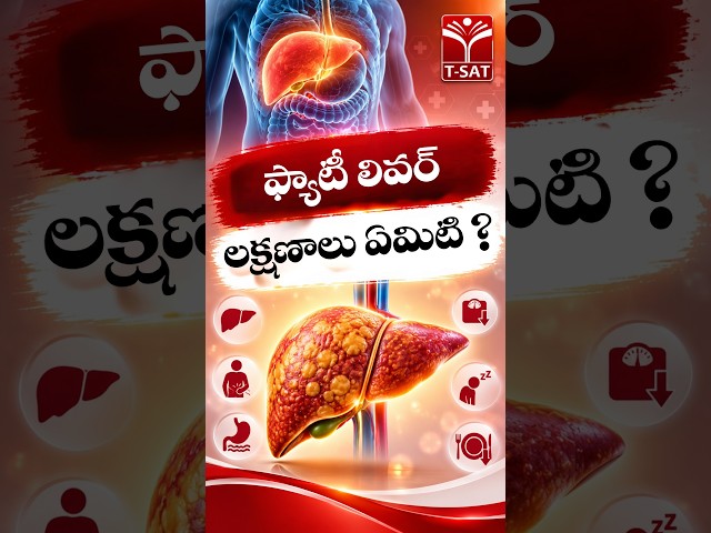 ఫ్యాటీ లివర్ లక్షణాలు ఏమిటి ? | T-SAT