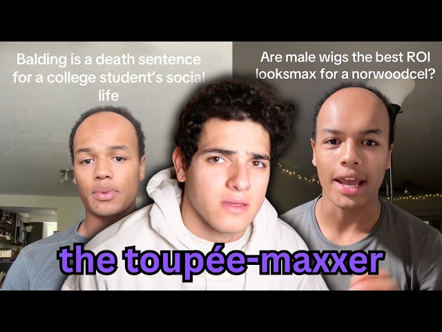 Balding College Student Goes Full Red Pill