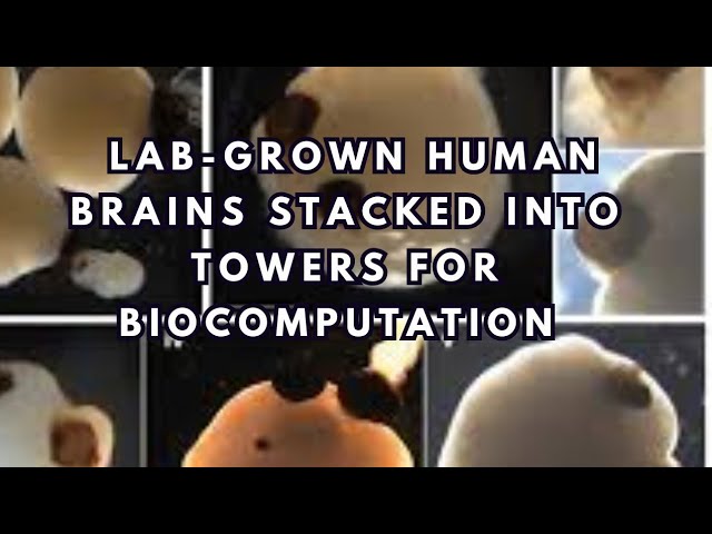 Lab-grown Human Brains Stacked into Towers for Biocomputers