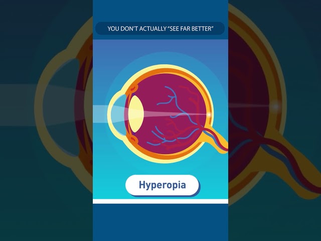 Why Hyperopia Sounds Better Than It Is