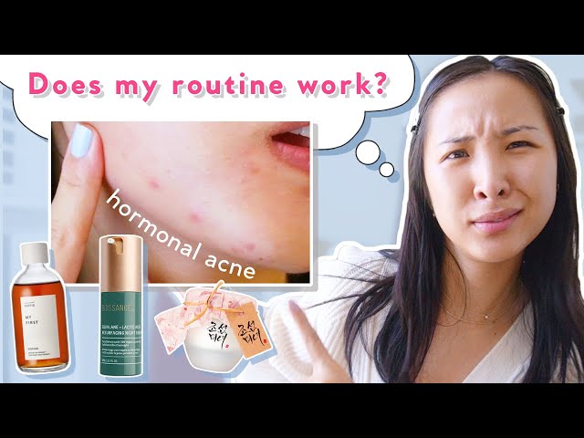 ☀️Day + Night🌙 Acne, Hyperpigmentation & Oily Skincare Routine | Fel's Faves