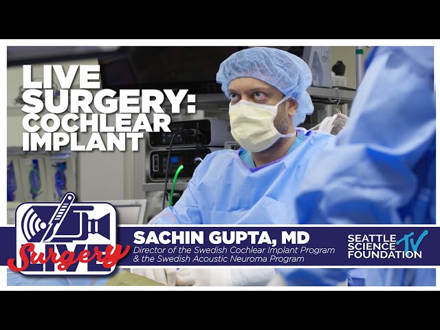 Live Endoscopic Ear Surgery - Cochlear Implant - Sachin Gupta, M.D.