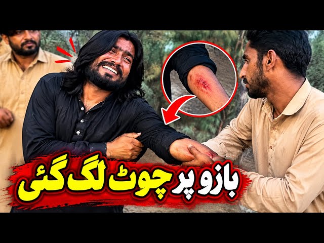 :Bazu Par Chot Lag Gai 😱 Raja Ko Kya Ho Gaya😱