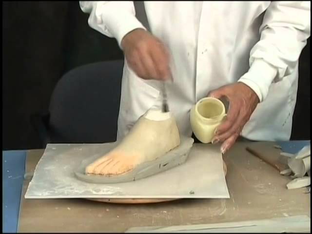 Custom Fabrication of A Silicone Partial Foot Prosthesis