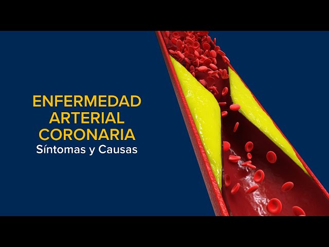 Enfermedad Arterial Coronaria (EAC) - Síntomas y causas