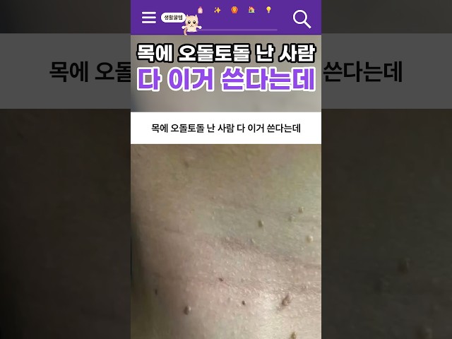 Everyone with skin tags on their neck is using this #Shorts #ShoppingRecommendation #HouseholdIte...
