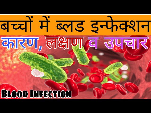 Blood Infection in Children - Knowledge TV