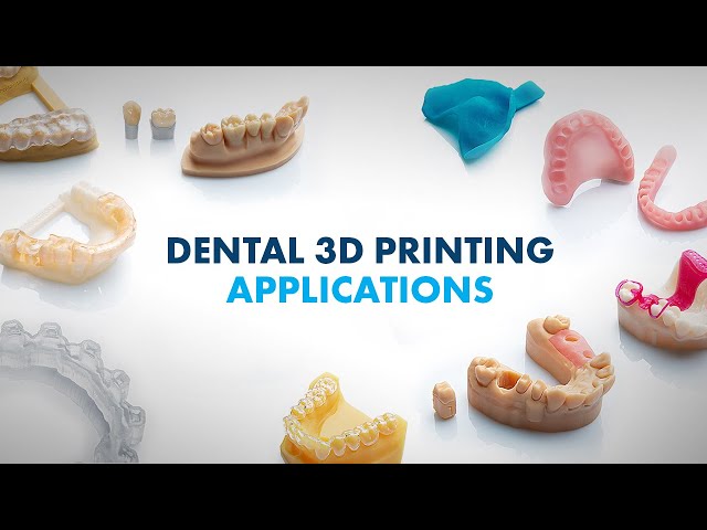 What can you print with a dental 3D printer? | Rapidshape Dental 3D Printing Applications