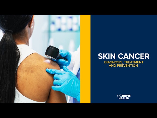 How to Spot and Prevent Skin Cancer: Tips From a Dermatologist | UC Davis Health
