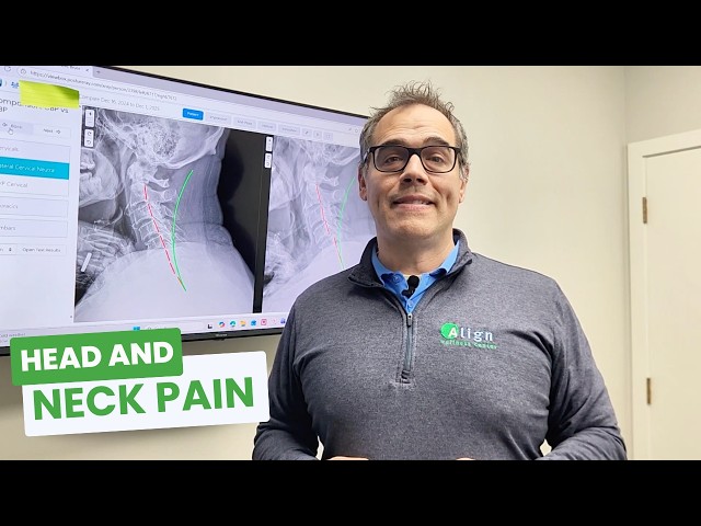 Head and Neck Pain | Align Wellness Center [2021]