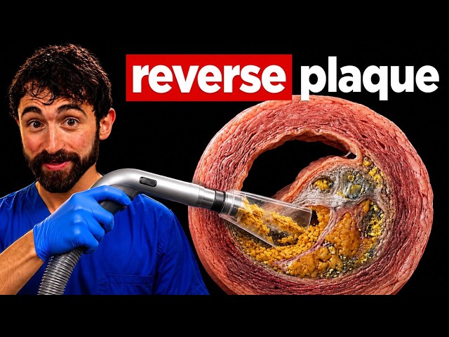 Reverse Heart Disease in 1 Year (Proven in RCT)