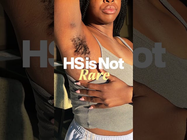Did You Know: HS EDITION #hidradenitissuppurativa