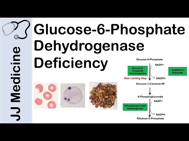 Glucose-6-Phosphate Dehydrogenase Deficiency | Symptoms, Pathophysiology, Diagnosis and Treatment