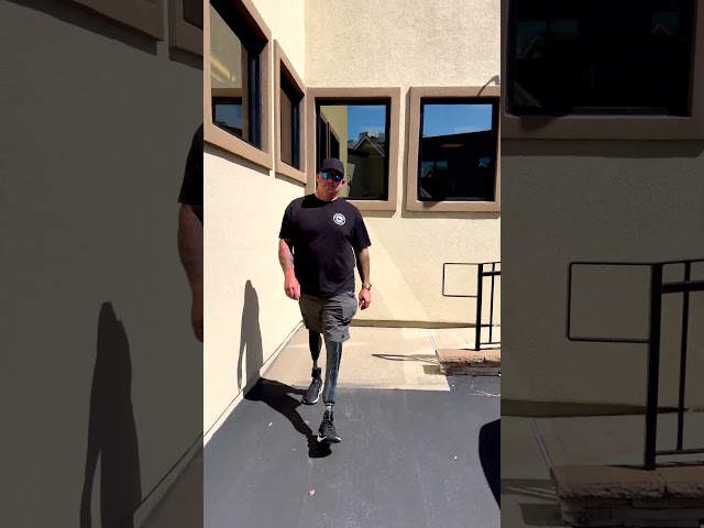 Walking with Bilateral Prosthetic Legs | Chris
