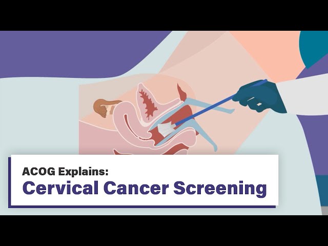 ACOG Explains: Cervical Cancer Screening