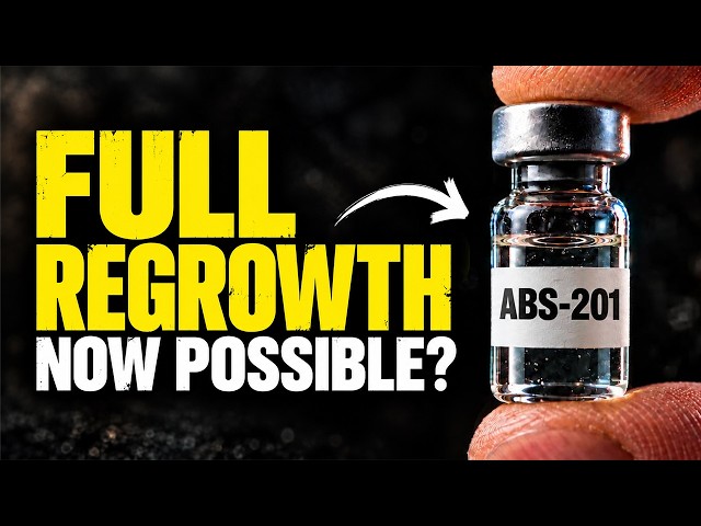 Prolactin Is THE Root Cause of Hair Loss?! Absci’s New Drug May Prove It