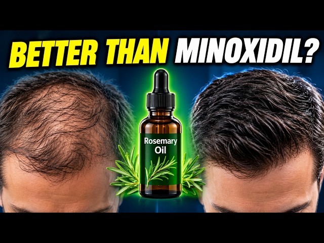 Rosemary Oil vs Minoxidil: What 6 Months Actually Did