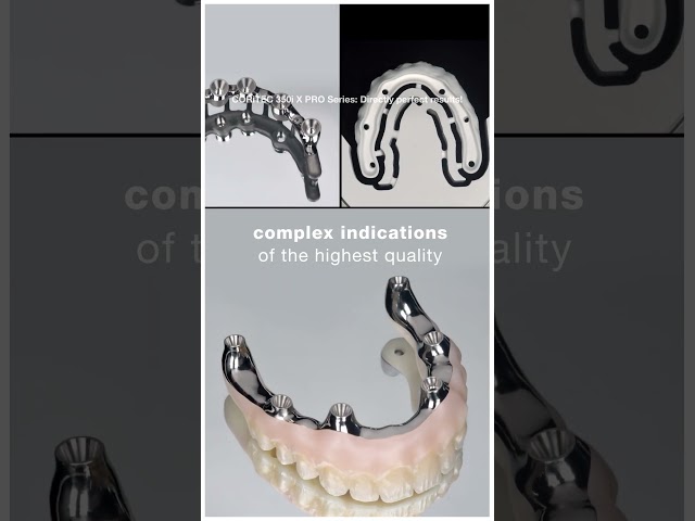 Complex Dental Indications with CORiTEC 350i x PRO  imes icore #dentalcaddesign