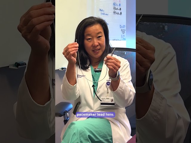 What Is a Pacemaker?