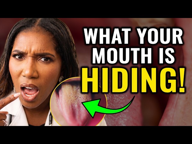 Kidney Disease Warning Signs In Your Mouth! Nephrologist Dr. Frita Explains Symptoms To Watch For