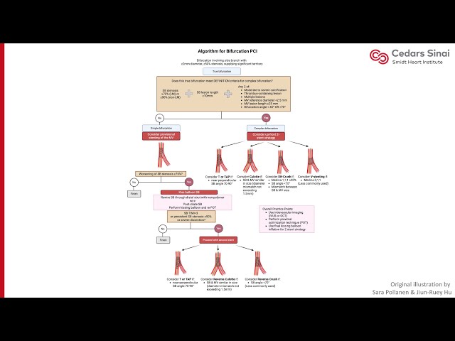 Visual Guide to Bifurcation PCI