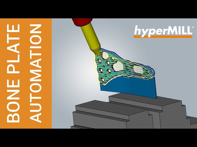 hyperMILL AUTOMATION CENTER: Bone Plate CAD/CAM Automation Use Case