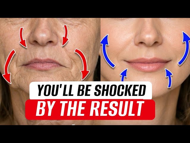 Drooping mouth corners add years to your face 😱 Fix Them Naturally