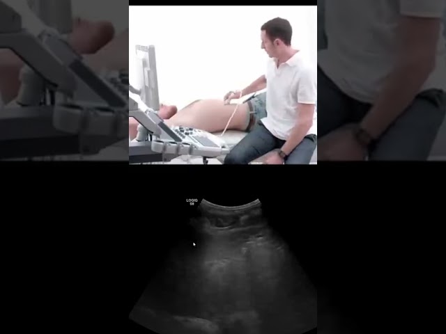 Evaluating the Left Liver Lobe Sound #shorts