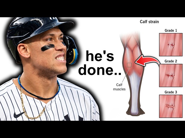 BREAKING: Aaron Judge Can’t Play Baseball Anymore..