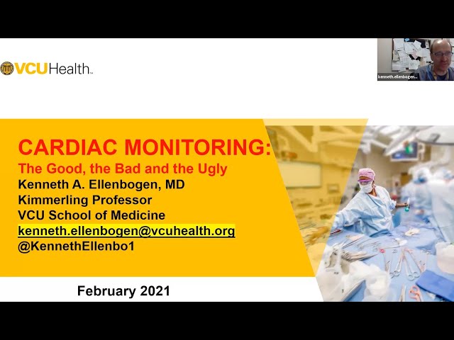 Cardiac Monitoring: The good the bad and the ugly