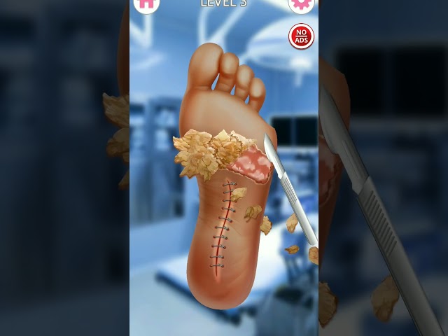 foot treatment 😮💥 #shorts #treatment #games #asmr #foottreatment #makeup #funny