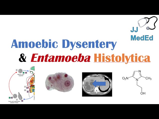 Amebiasis (Amoebic Dysentery) | Entamoeba histolytica, Pathogenesis, Signs & Symptoms, Treatment
