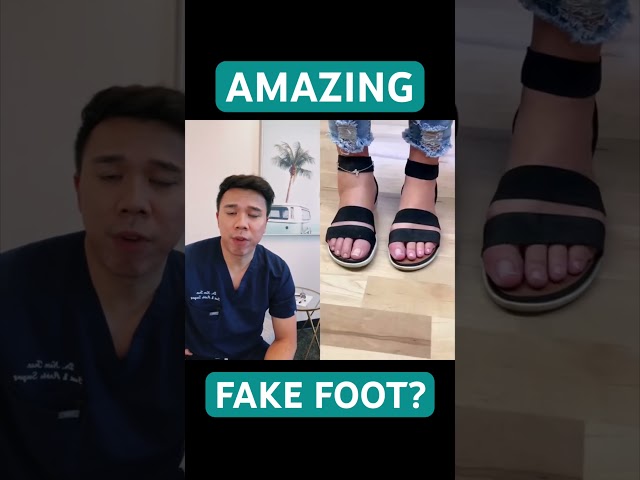 This prosthetic foot is absolutely AMAZING! #shorts #doctor #foot #prosthetics