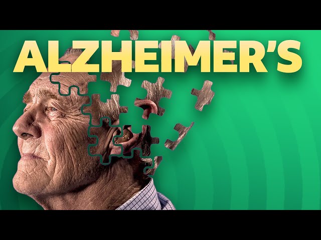 What causes Alzheimer's Disease?