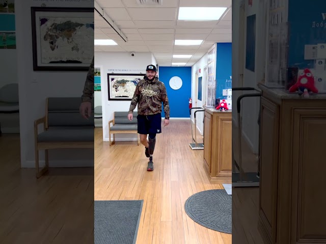 Nate’s 1-Year Progress with His Prosthetic Leg | Below-Knee Amputee Transformation
