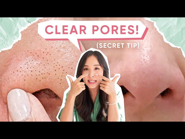 My *no fail* Routine for BLACKHEADS, LARGE PORES & ACNE!👌