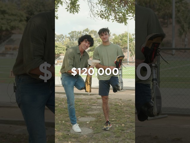 The MOST EXPENSIVE Prosthetic Leg vs the CHEAPEST??