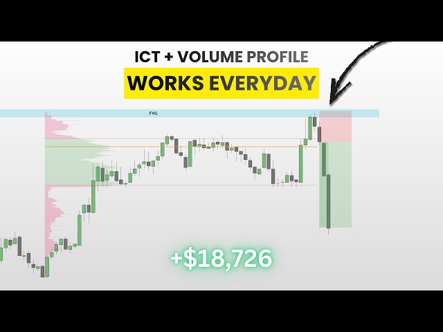 ICT + Volume Profile = Insane Profit