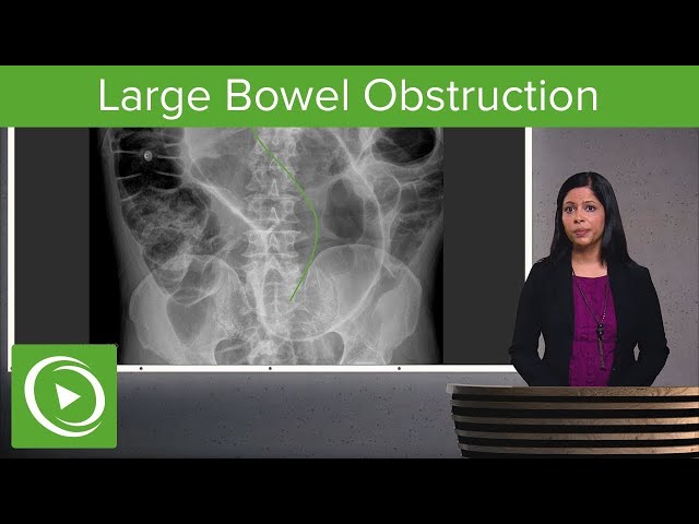 What Causes Large Bowel Obstruction? 🔍🩻