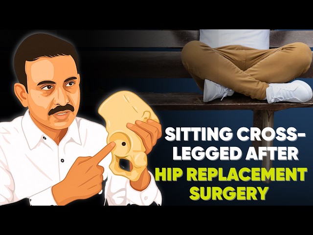 SITTING CROSS-LEGGED AFTER DIRECT ANTERIOR HIP REPLACEMENT SURGERY  *updated 2025
