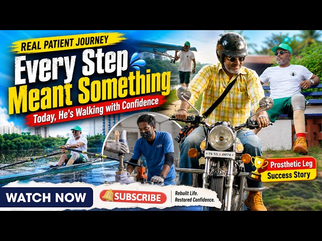 Climbing Stairs & Riding Bikes: Life With My New Prosthetic Leg