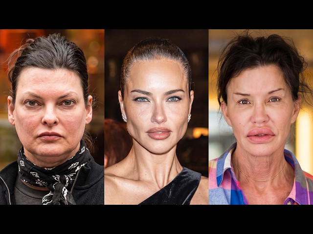 14 Supermodels Who Took Plastic Surgery Too Far | Then and Now 2026