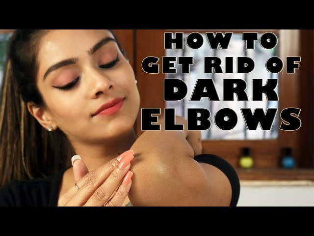 How To Get Rid Of Dark Elbows | Remove Darkness From Elbows | Skincare Tutorial | Foxy Makeup