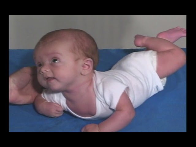 Pediatric Neurologic Exam: Normal 3-Month Old