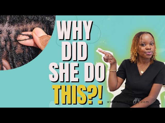 Her Loctician Combined Almost ALL Her Locs… Here’s What Went Wrong | Sisterlocs | Microlocs 
