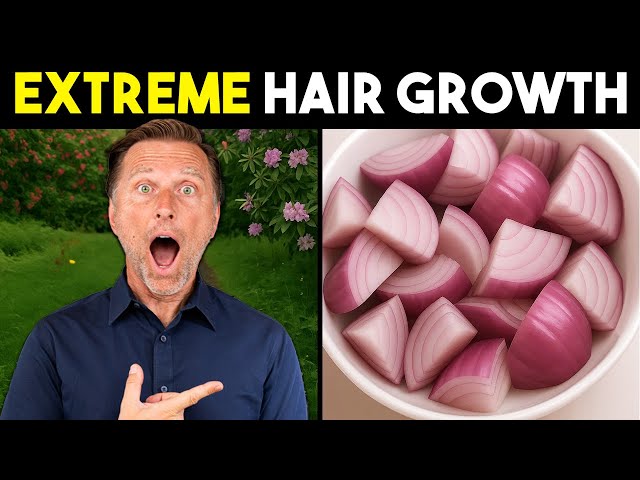 Onion Juice for Extreme Hair Growth: Stop Hair Loss